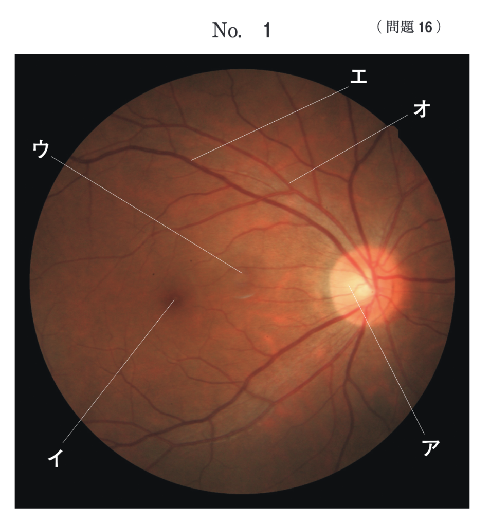 無散瞳眼底写真画像